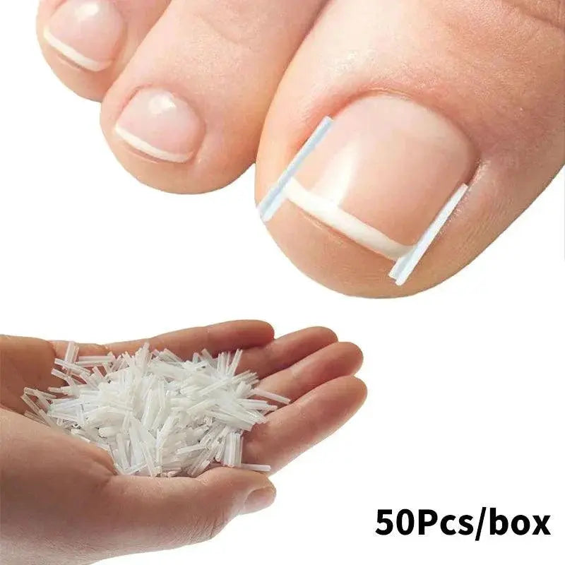 Ingrown Toenail Correction Kit For Home And Professional Use