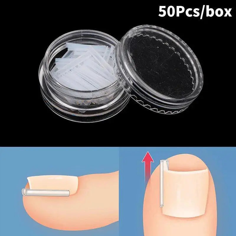Ingrown Toenail Correction Kit For Home And Professional Use
