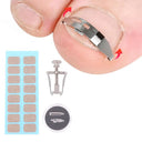 Ingrown Toenail Corrector Kit Professional Foot Care Solution