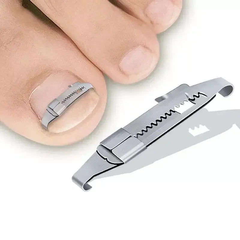 Ingrown Toenail Corrector Kit For Home Foot Care Solution