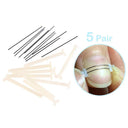 Ingrown Toenail Corrector Kit Professional Foot Care Solution