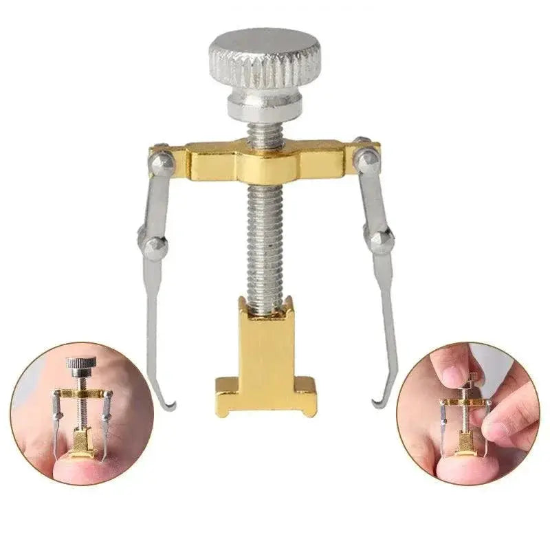 Ingrown Toenail Corrector Pro Foot Care Tool At Home