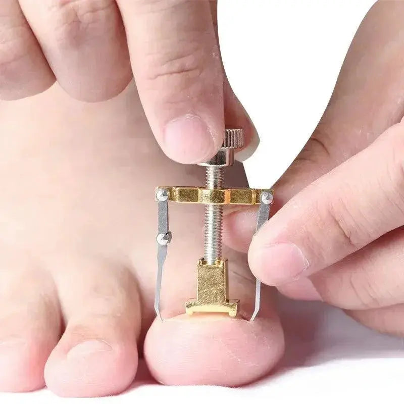 Ingrown Toenail Corrector Pro Foot Care Tool At Home