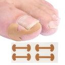 Ingrown Toenail Corrector Stickers Healthy Nail Care Solution