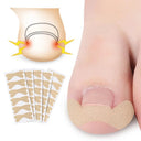 Ingrown Toenail Corrector Stickers Healthy Nail Care Solution