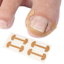 Ingrown Toenail Corrector Stickers Healthy Nail Care Solution