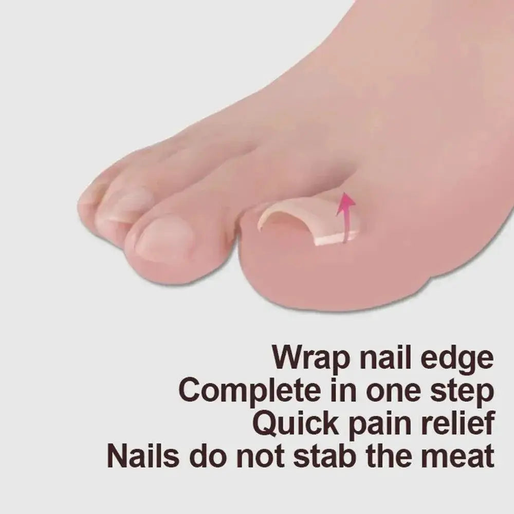 Ingrown Toenail Relief Orthopedic Nail Correction Tool