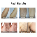 IPL Hair Removal Device For Home