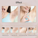 IPL Hair Removal Device For Home