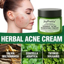 JoyPretty Acne Cream for Oily Skin Care