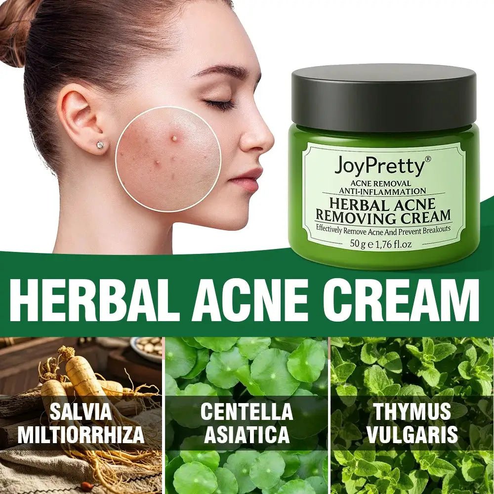 JoyPretty Acne Cream for Oily Skin Care
