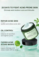 JoyPretty Acne Cream for Oily Skin Care