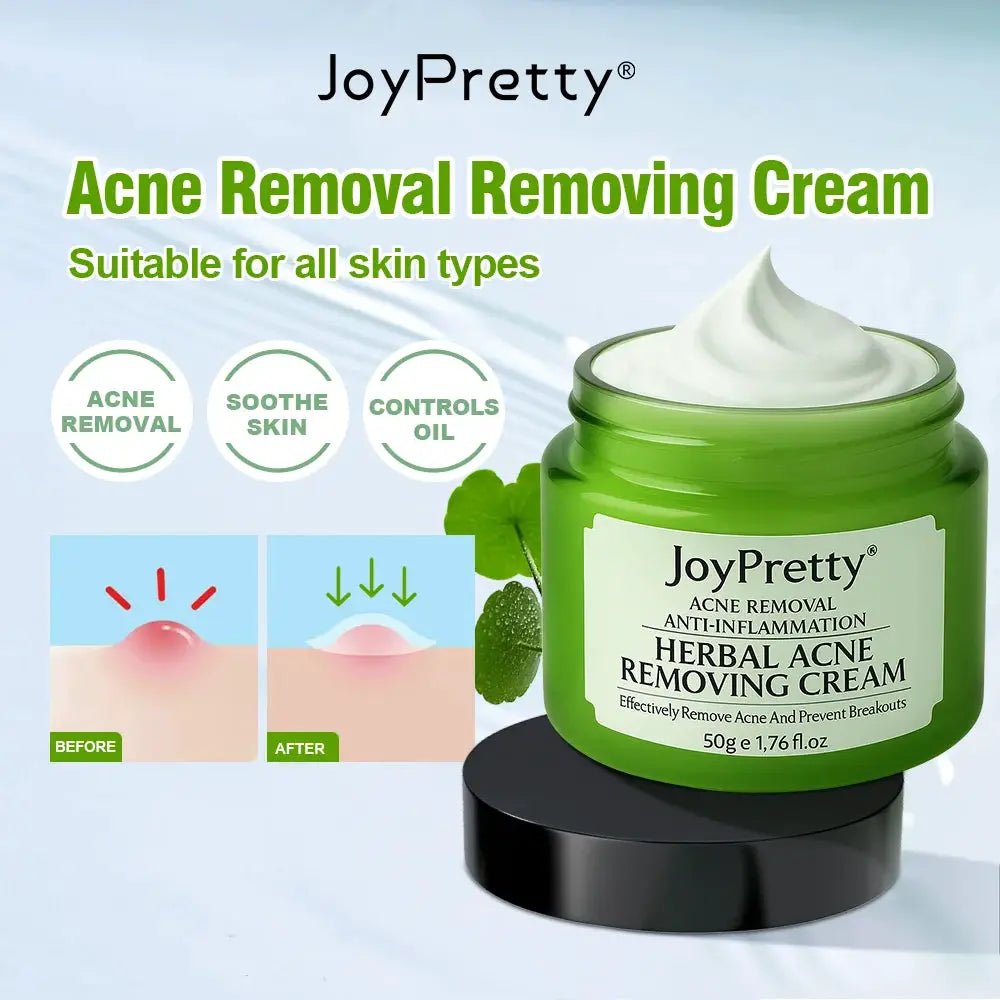 JoyPretty Acne Cream for Oily Skin Care