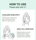 JoyPretty Acne Cream for Oily Skin Care