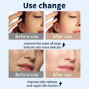 LED Face Mask for Home Skin Rejuvenation
