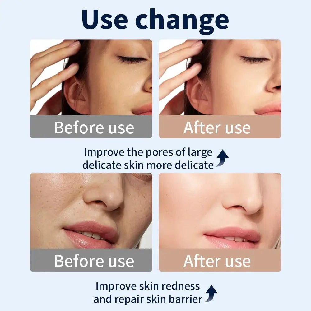 LED Face Mask for Home Skin Rejuvenation