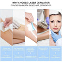 Long-Lasting IPL Device for Home Use