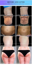 Muscle Sculpting EMS RF Device for Home