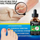 Nail Fungus Repair Serum: Natural Gel for Healthy Nails