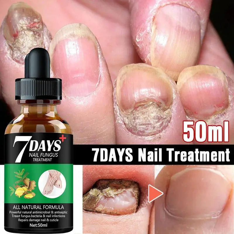 Nail Fungus Repair Serum Natural Gel For Healthy Nails