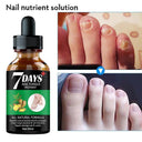 Nail Fungus Repair Serum: Natural Gel for Healthy Nails