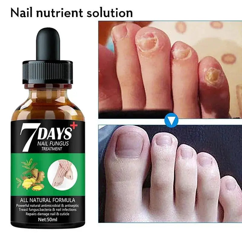 Nail Fungus Repair Serum Natural Gel For Healthy Nails