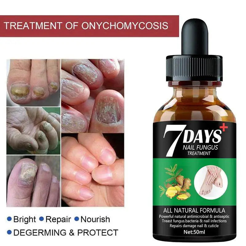 Nail Fungus Repair Serum Natural Gel For Healthy Nails