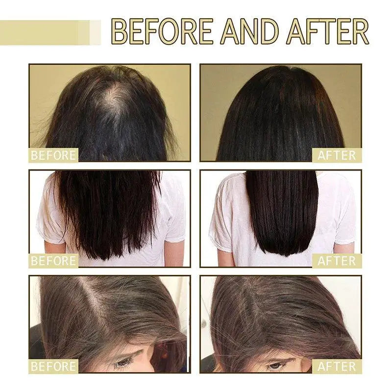 Natural Hair Growth Serum For Damaged Hair Repair Strengthen