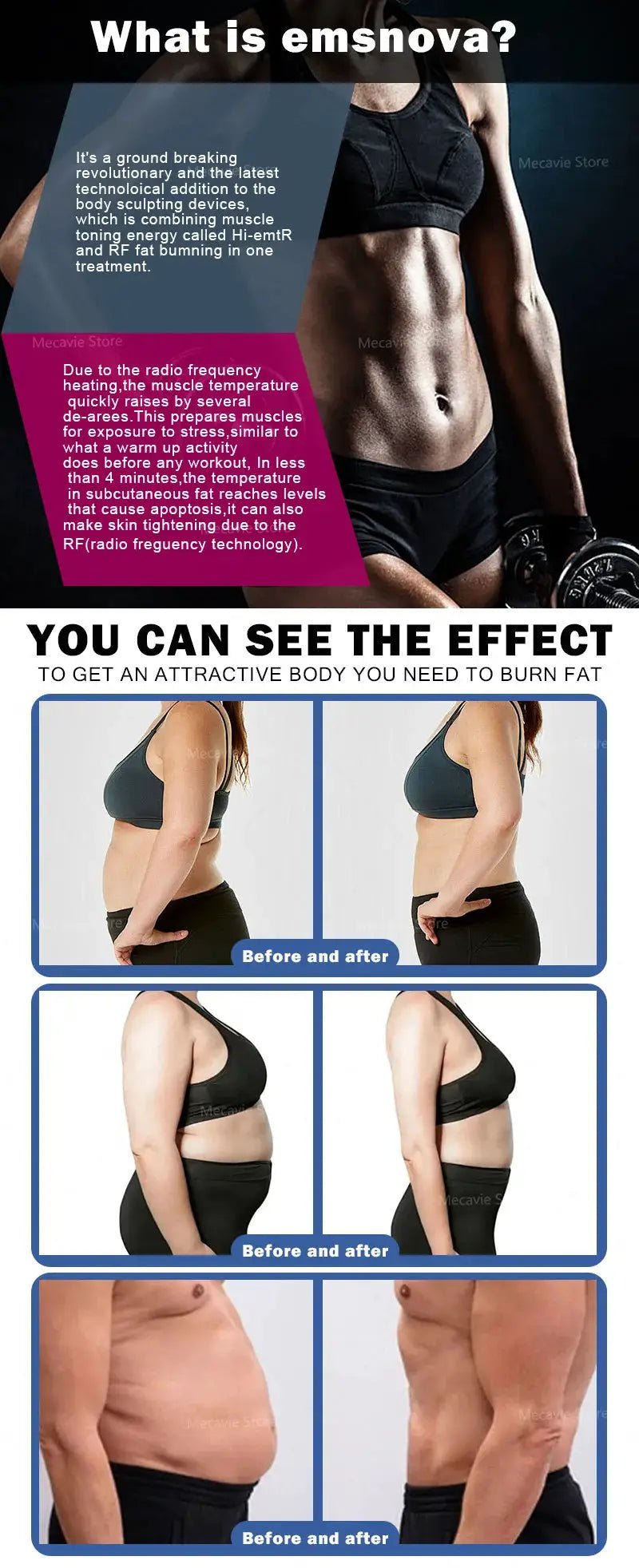 Noninvasive Fat Loss EMS Slimming Device — product view 10
