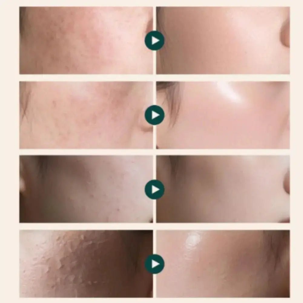 Oil Control Moisturizer for Oily Skin