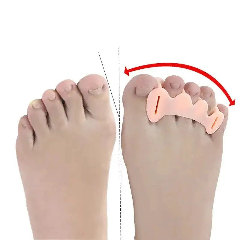 Orthopedic Bunion Toe Separator For Pain Relief And Support