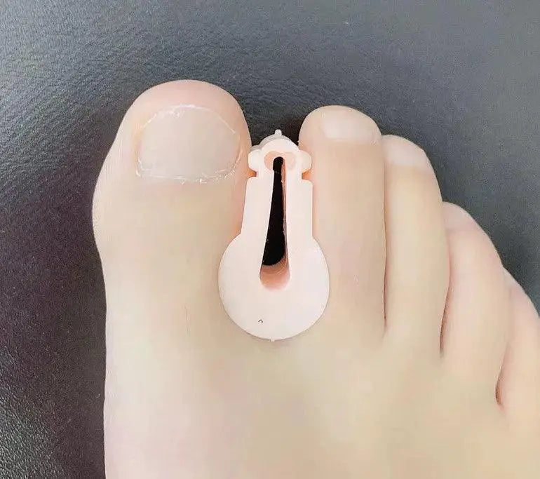 Orthopedic Toe Care Kit For Hammer Toes And Bunions Relief
