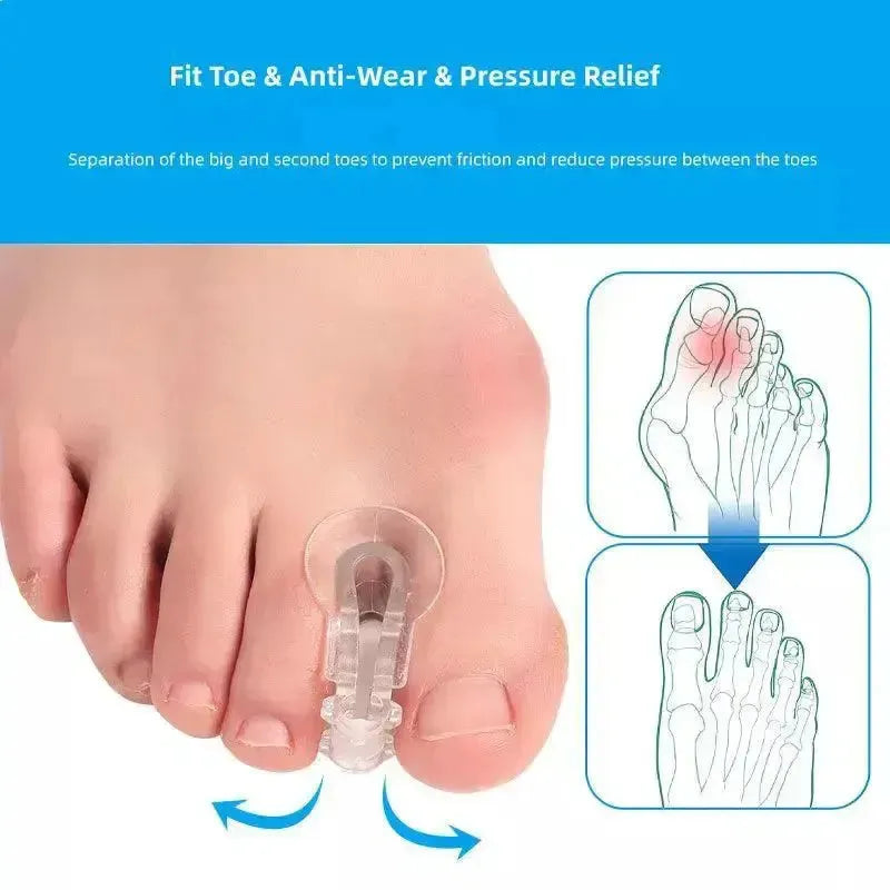 Orthopedic Toe Care Kit For Hammer Toes And Bunions Relief