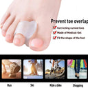 Orthotic Toe Separator Rings For Hallux Valgus Alignment Set