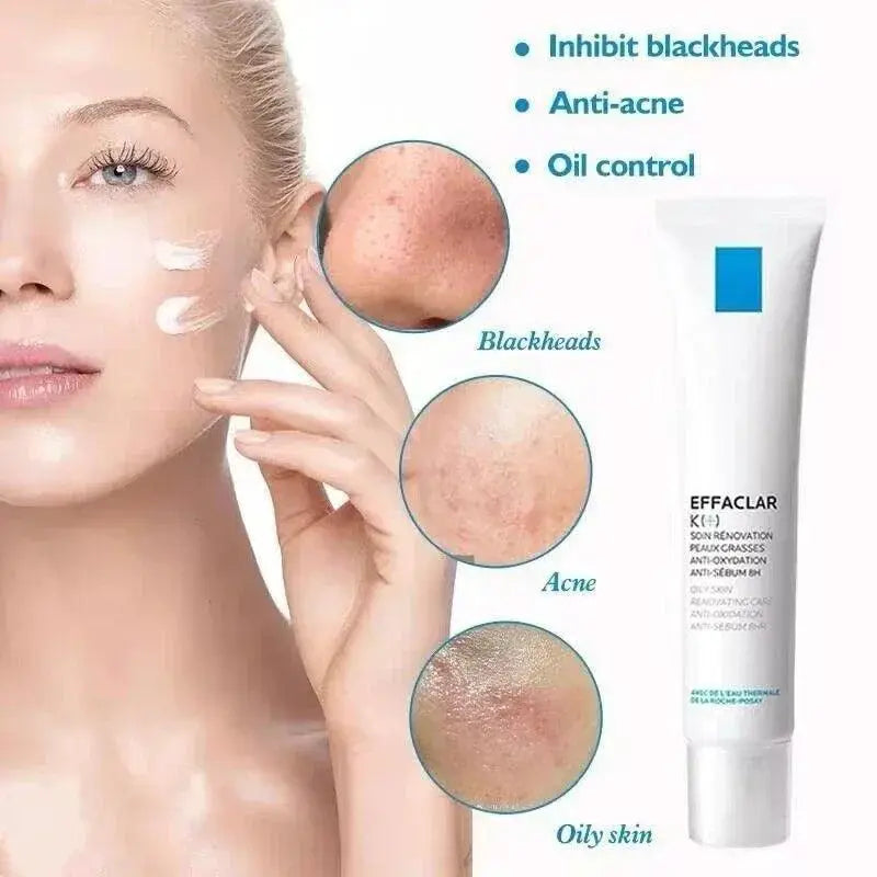 Revitalizing Retinol Acne Cream SPF 50 For Clear Skin