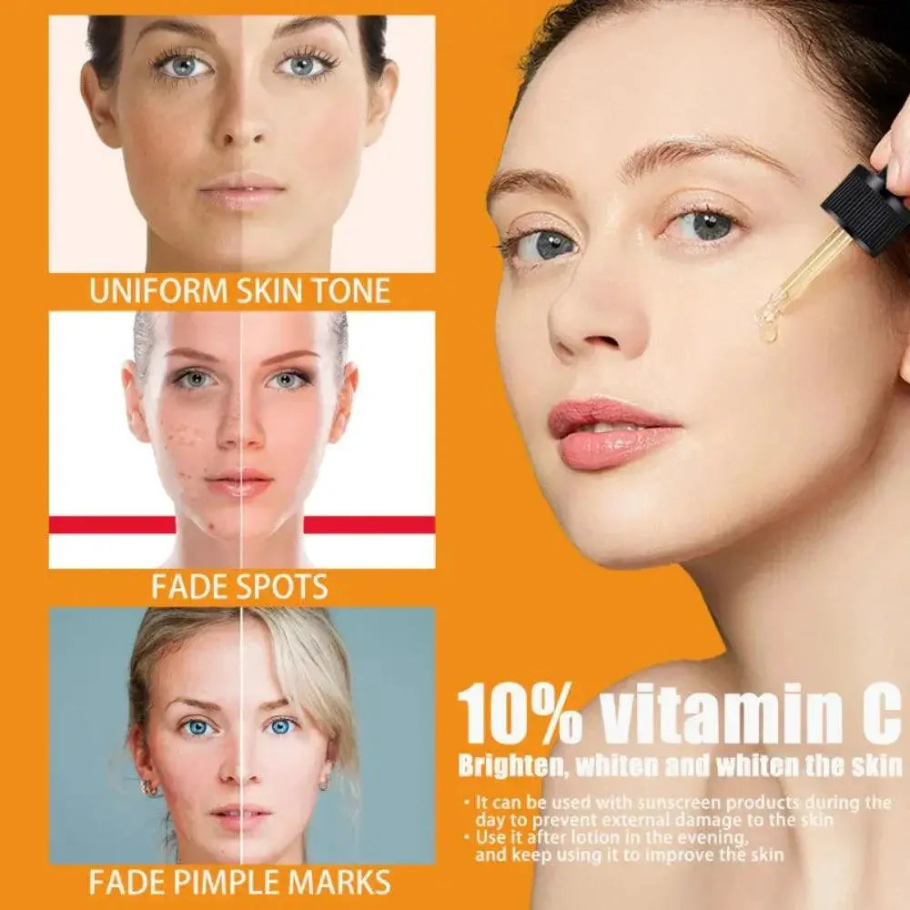 Vitamin C Brightening Serum Dark Spot Remover Anti Aging