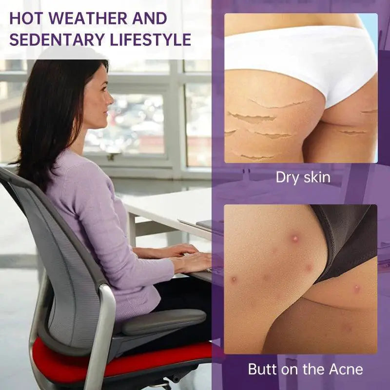 Acne Treatment Cream For Buttocks And Thighs Fast Relief