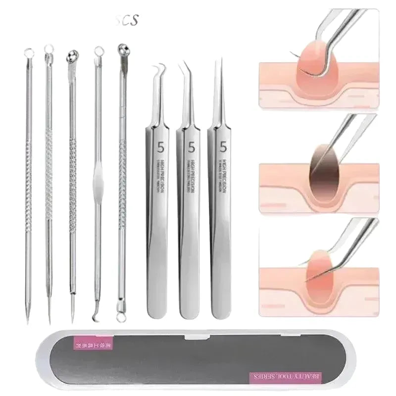 Clearer Skin Blackhead Kit for Home Use — product view 1