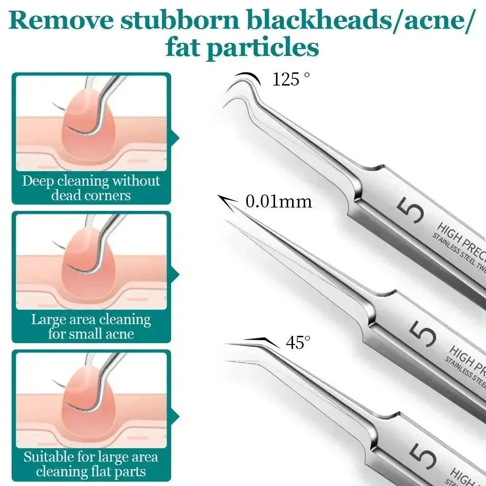 Ultimate Blackhead Removal Set For Clear Skin Tools
