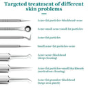 Clearer Skin Blackhead Kit for Home Use