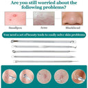 Clearer Skin Blackhead Kit for Home Use