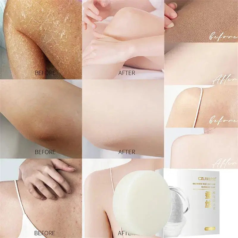 Anti Wrinkle Radiant Skin Whitening Soap For Brightening