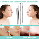 Blackhead Removal Kit for All Skin Types