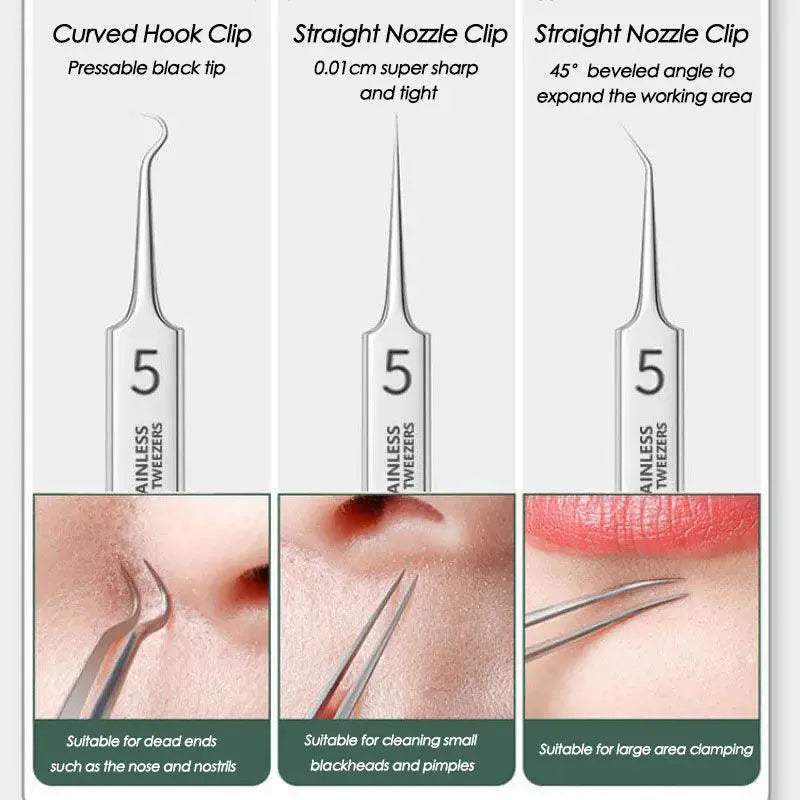 Stainless Steel Blackhead Removal Kit For Clear Skin