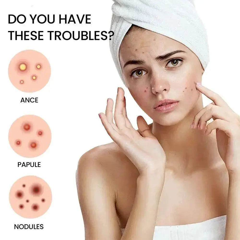 Acne Treatment Patches for Fast Healing and Clear Skin