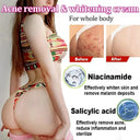 Booty Cream For Acne And Dark Spots