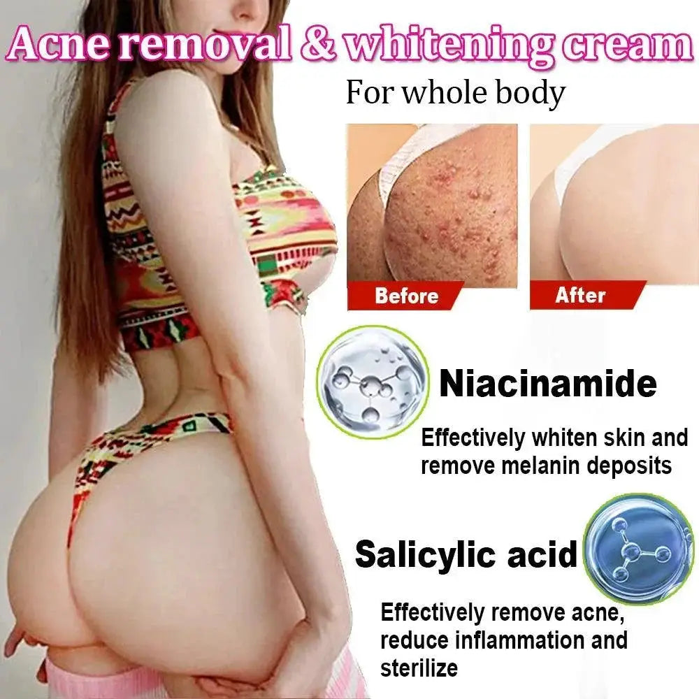 Niacinamide Booty Cream For Acne And Dark Spots Brightening