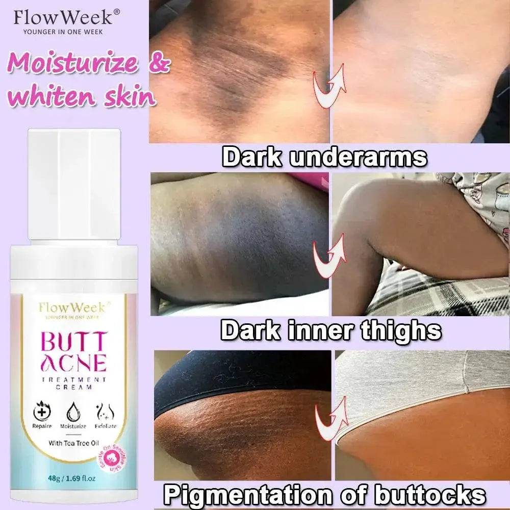 Niacinamide Booty Cream For Acne And Dark Spots Brightening