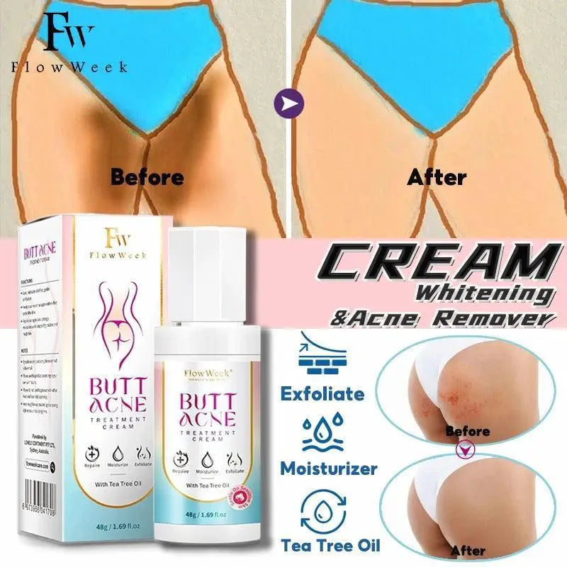 Niacinamide Booty Cream For Acne And Dark Spots Brightening