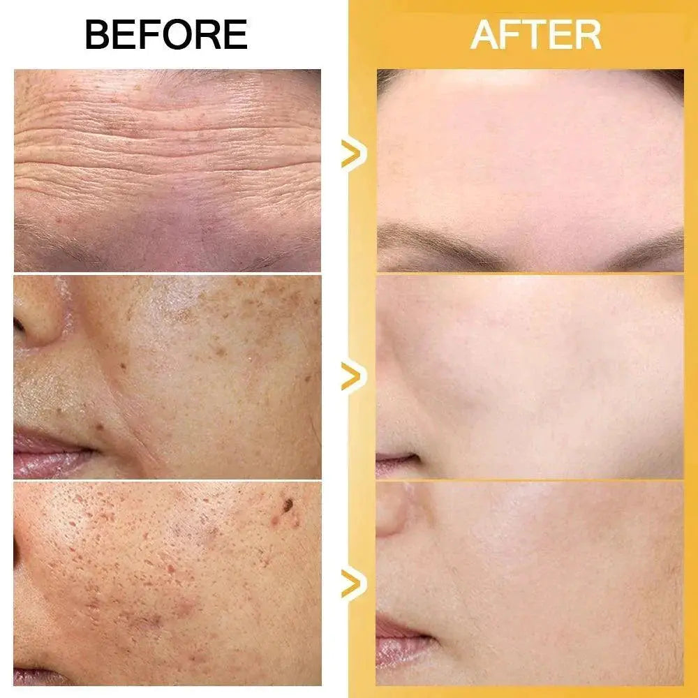 Anti Wrinkle Golden Glow Radiant Skin Essence Serum 50ml Pro